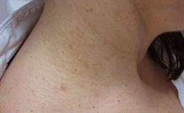 OveallgoTM WartsOff Instant Blemish Removal Cream