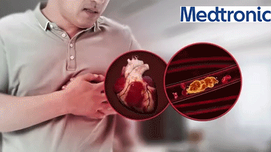 1704638194683159.gif Choroba niedokrwienna serca.gif