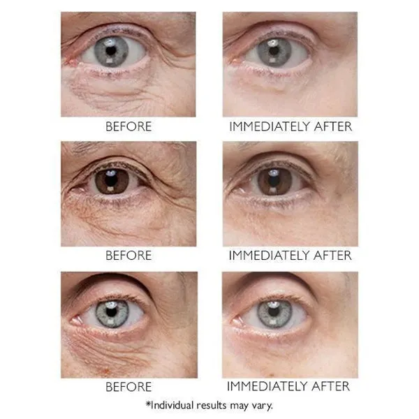 Last Day 49% OFF🎁Instant Eye Temporary Eye Tightener💕