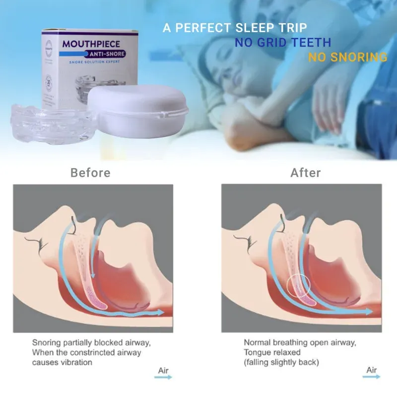 SereneSleep Mouthpiece