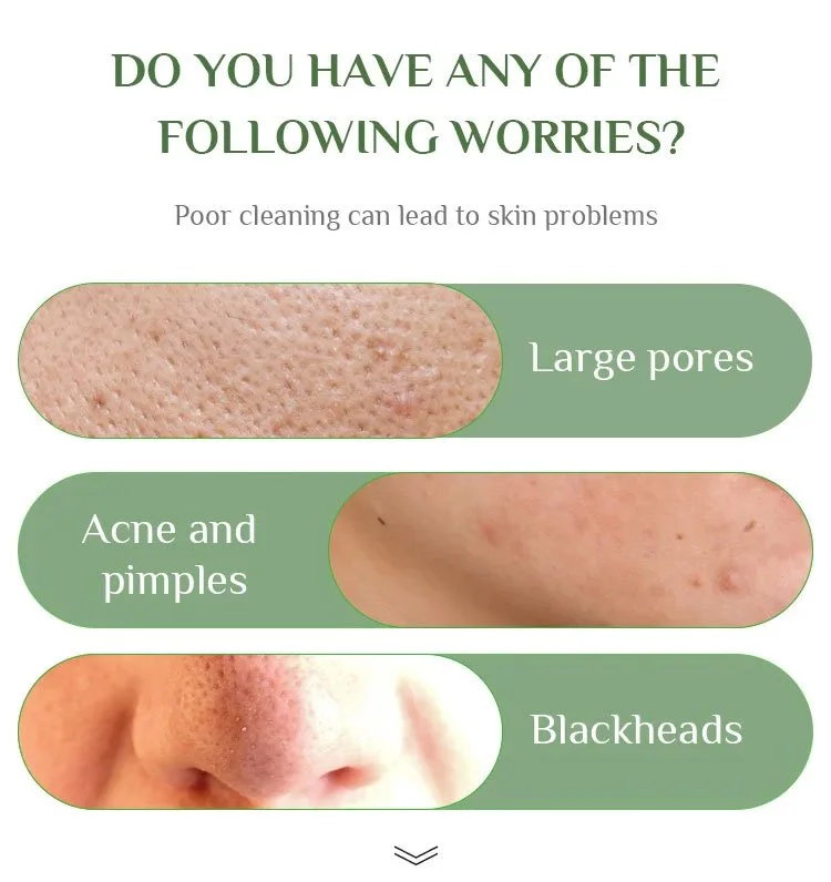 🎁 Deep Cleanse Green Tea Mask