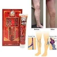 Khalesexx healthe 100% Original Veins Varicose Treatment Plaster Treatment...