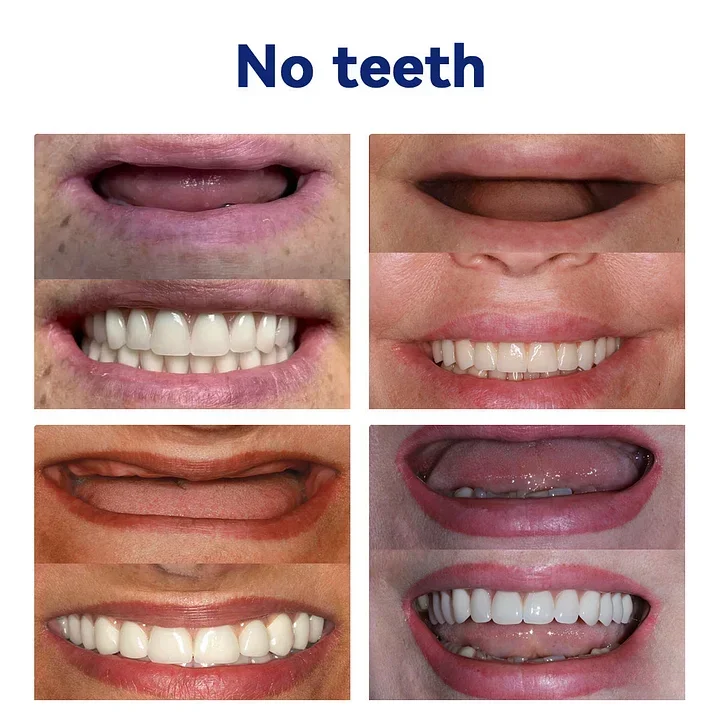 🦷Advanced Customized Full Denture Set🦷