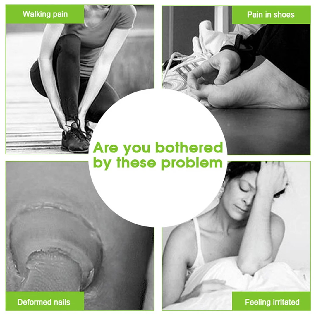 Ingrown Nail Recover Correction Pedicure Toenail Fixer Ingrown Foot