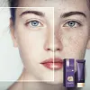 🎁&Alpha;&gamma;&omicron;&rho;ά&sigma;&tau;&epsilon; 1 &kappa;&alpha;&iota; &pi;ά&rho;&tau;&epsilon; 1 &Delta;&omega;&rho;&epsilon;ά&nu; &mu;&epsilon; &Delta;&Omega;&Rho;&Epsilon;&Alpha;&Nu; &Beta;&Omicron;&Upsilon;&Rho;&Tau;&Sigma;&Alpha;&Kappa;&Iota; &Sigma;&Omega;&Mu;&Alpha;&Tau;&Omicron;&Sigma; ✨- &Tau;έ&lambda;&epsilon;&iota;&alpha; &kappa;ά&lambda;&upsilon;&psi;&eta; &sigma;ώ&mu;&alpha;&tau;&omicron;&sigmaf;✨