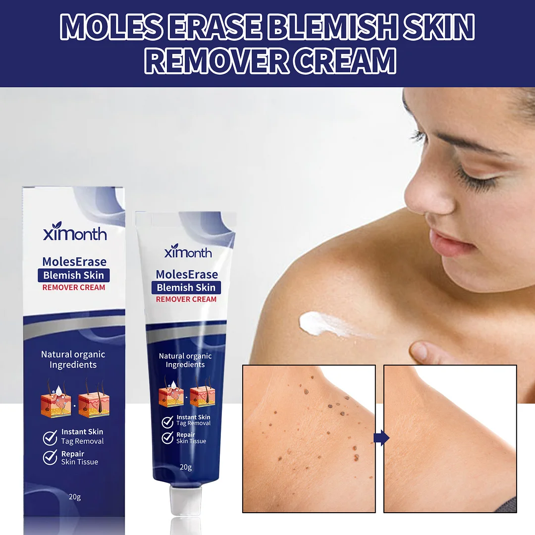 Clear Warts Instant Blemish Removal Cream