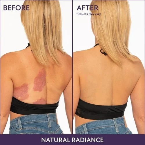 Perfect Cream &ndash; All-in-one moisturizer, concealer & coverage 💧✨ Lightweight & waterproof