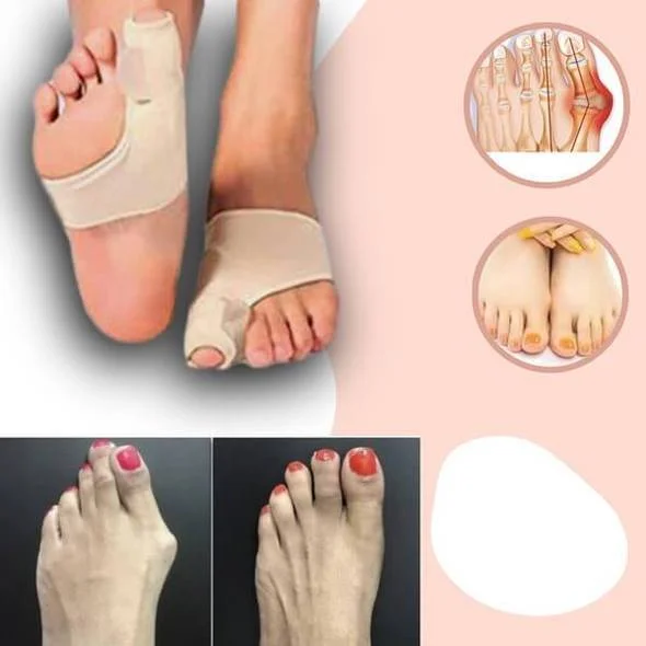 Orthopedic Toe Bunion Corrector 1 Pair (Left & Right)