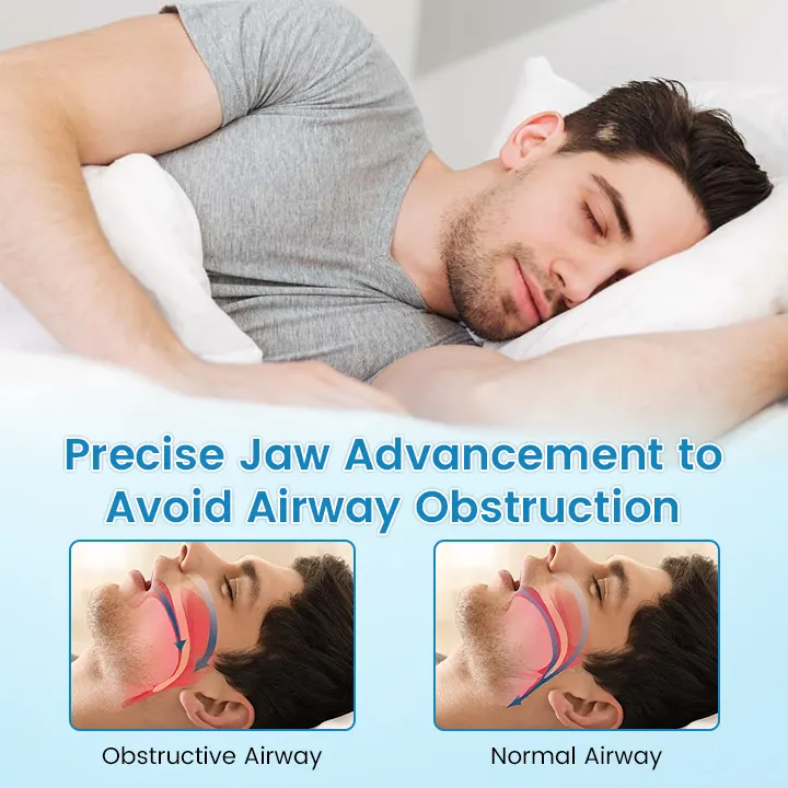 🌙 SILENT NIGHTS, STRONG TEETH! 🦷 QIAWI&trade; Anti-Snoring Guard 🔵✨
