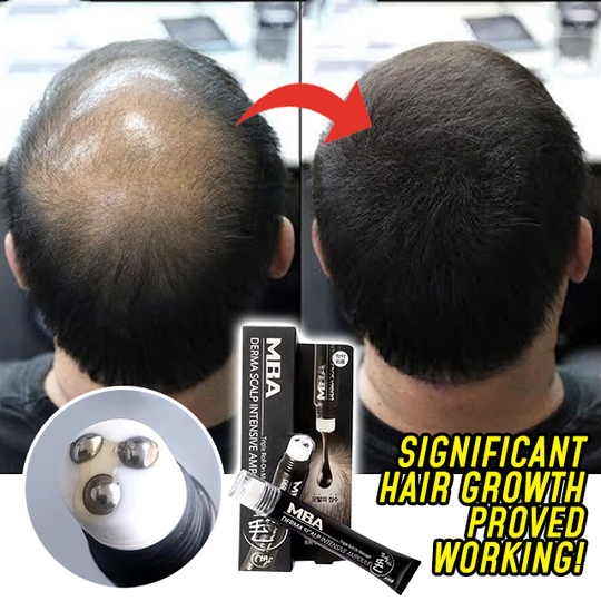 Roll-on Hair Growth Serum