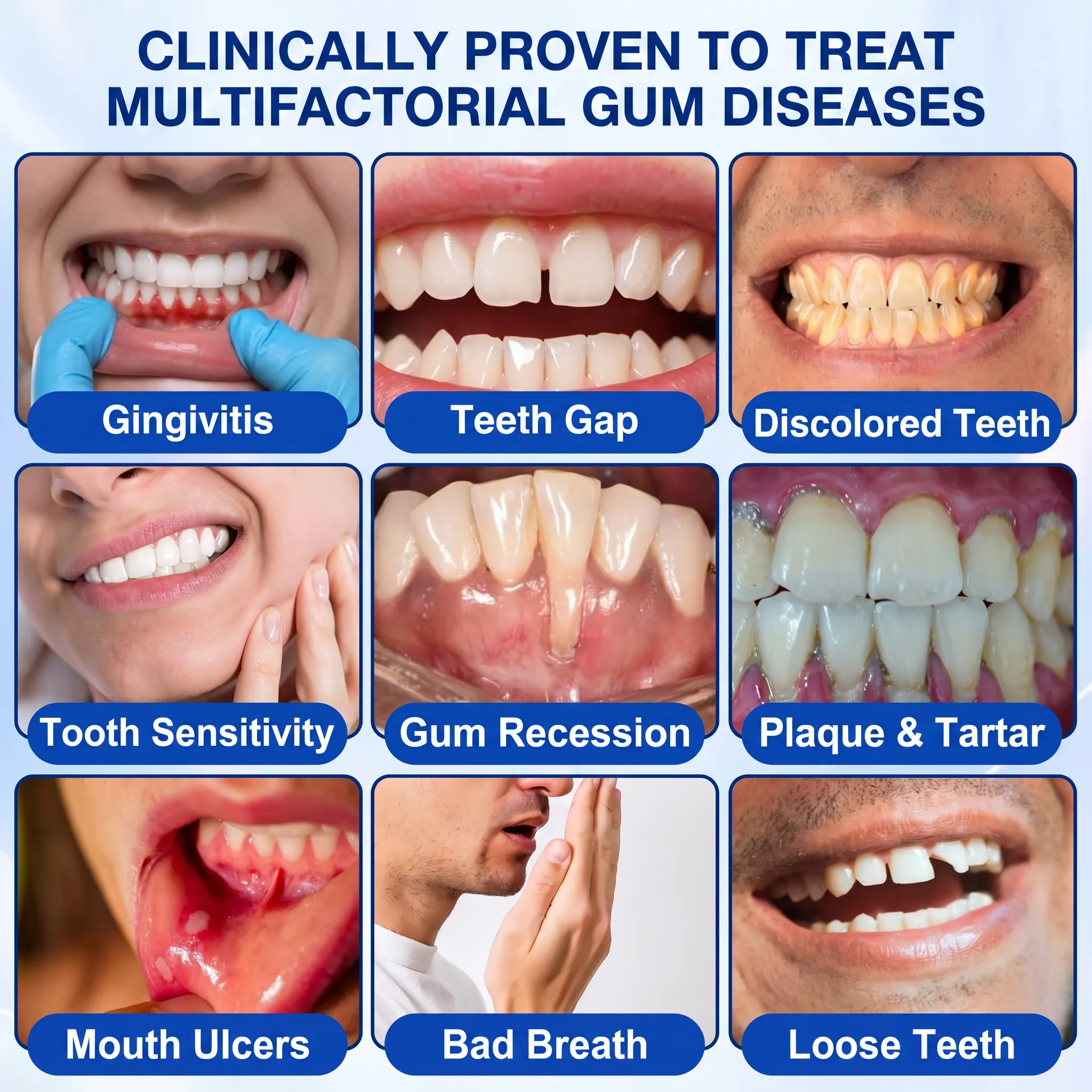 Periodontal pocket illustration