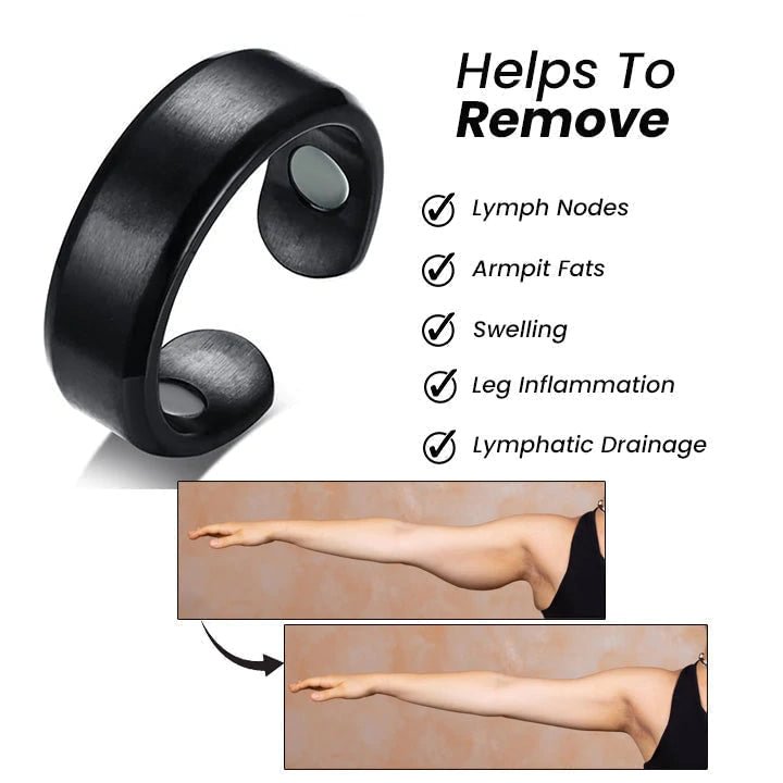 Magnetic Lymphatic Drainage Therapy Ring (Limited Time Offer 🔥Last Day)