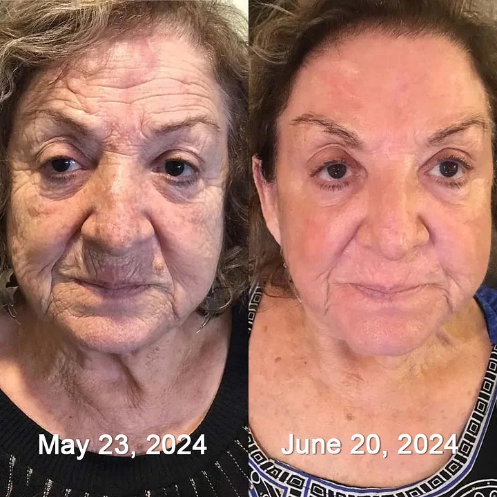 Laozik™ Botox Bee poison Firming Serum Stick