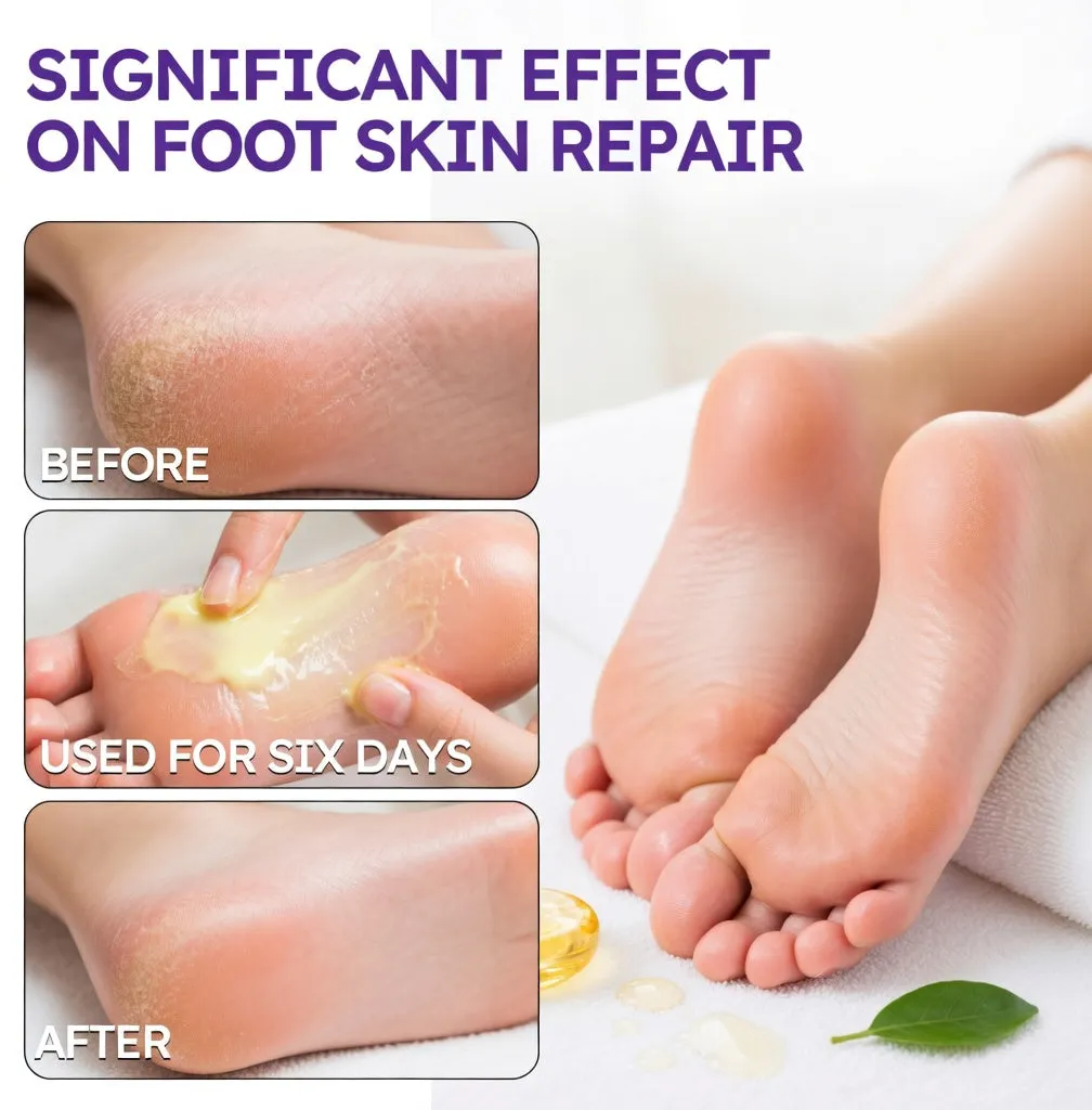 🎁 NEWYUO™ Limited-Time Offer 🎁 - Don't miss out!Tea Tree Oil Foot Cream (Repairs Dry Cracked Heels, Soothes Tired Feet, Eliminates Odor & Restores Soft Skin)