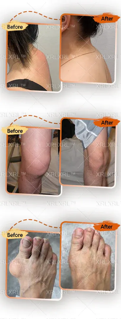 Alcuras® Bee Venom Pain-Relief Bone Healing Cream 🇺🇸(Specially for older adults)