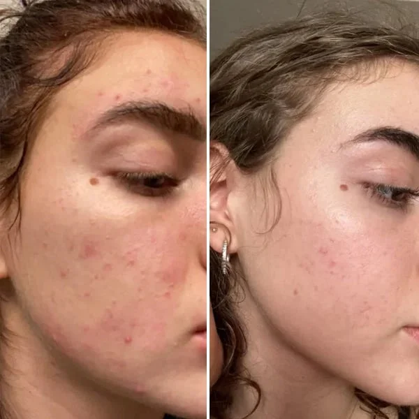 Turmeric Wash and Care two PieceSet 43