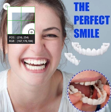 Magic Smile Teeth Brace