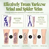 Vein Relief Cream
