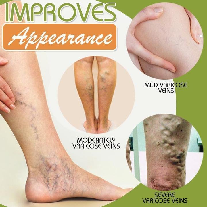 Spider Leg Repair Cream