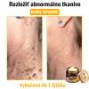 🧑&zwj;⚕️O&scaron;etrenie kožn&yacute;ch probl&eacute;mov zahňa: vekov&eacute; &scaron;kvrny, jazvy, bradavice, kožn&eacute; akn&eacute;, furuncle, akn&eacute;, ekz&eacute;my, psori&aacute;za, acne inversa, akn&eacute;, jazvy po akn&eacute; a in&eacute;.