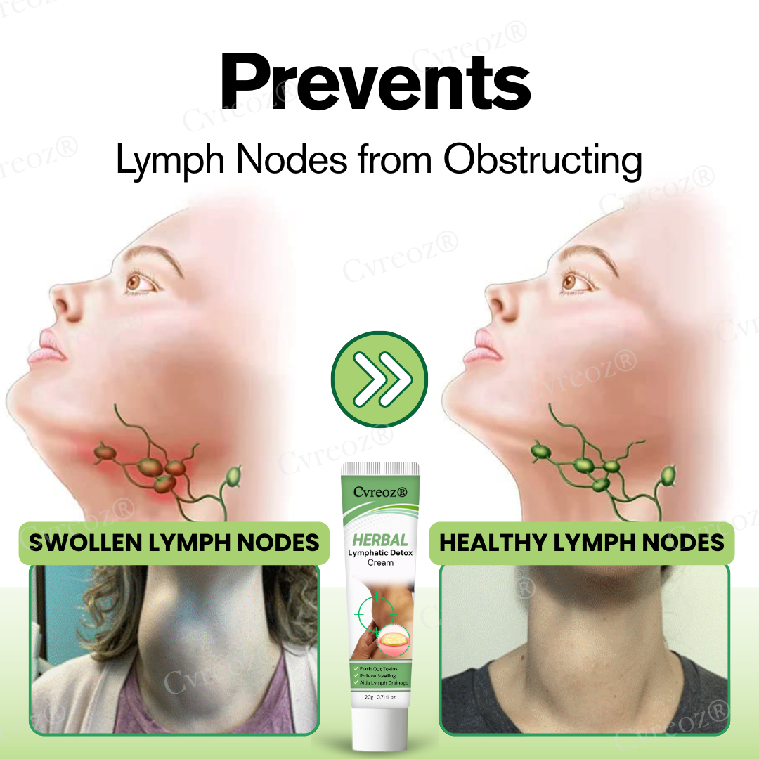 🔥Hot Sale 49% Off🔥 Herbal Lymphatic Detox Cream