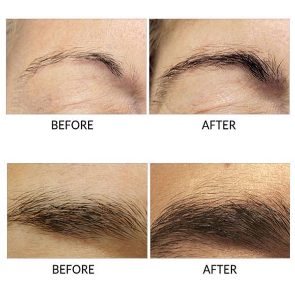 Eyebrows Growth Serum | 168DEAL
