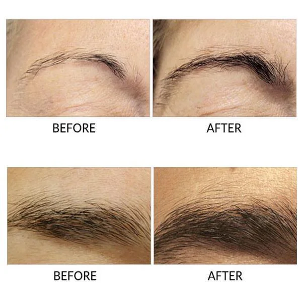 Eyebrows Growth Serum | IFYHOME