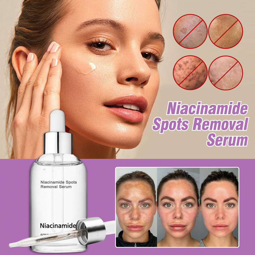 🎉Niacinamide Spots Removal Serum