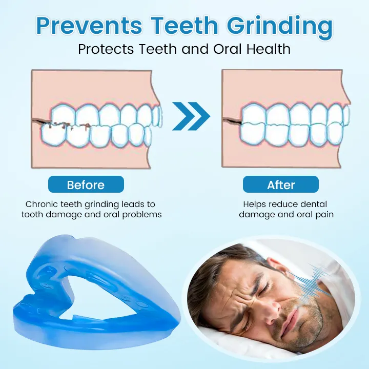 🌙 SILENT NIGHTS, STRONG TEETH! 🦷 QIAWI&trade; Anti-Snoring Guard 🔵✨