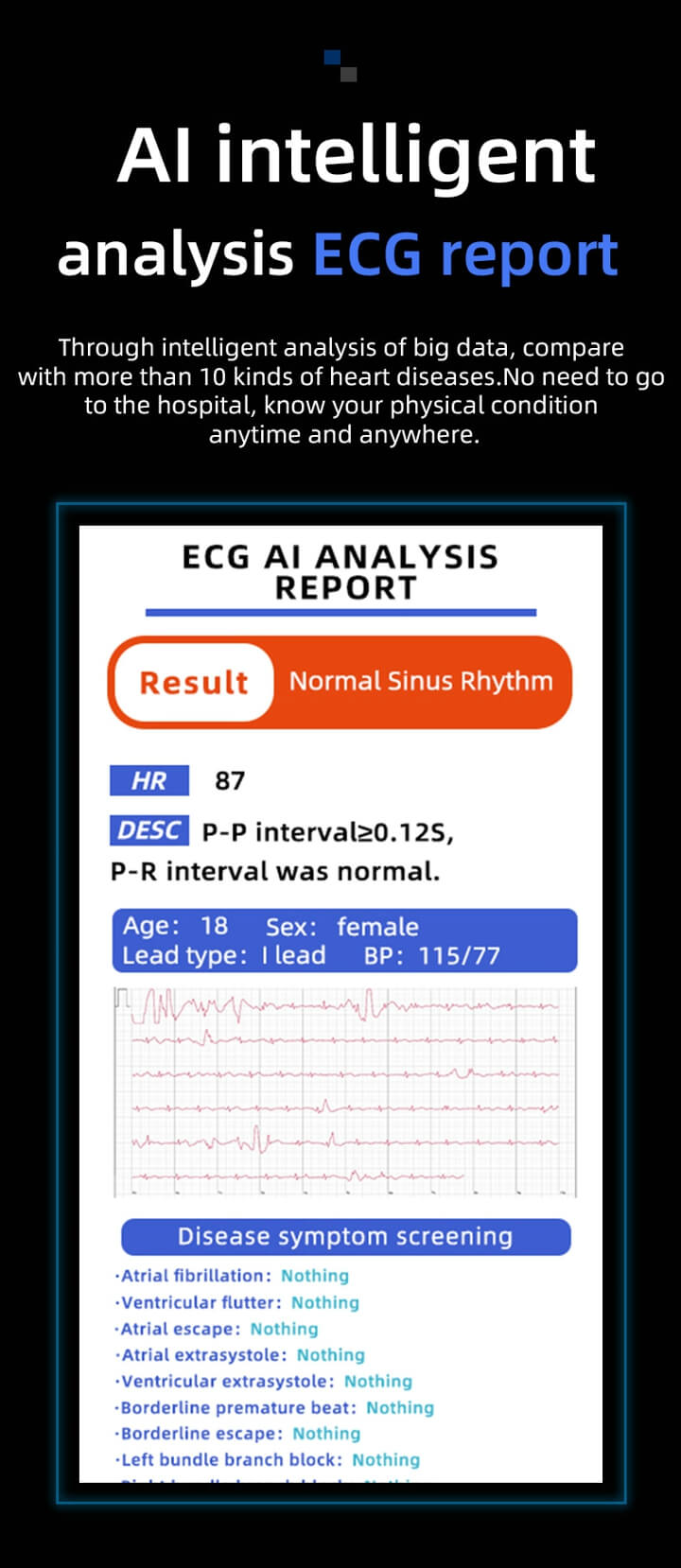 Findtime S43 Smart Watch with Glucose Monitor