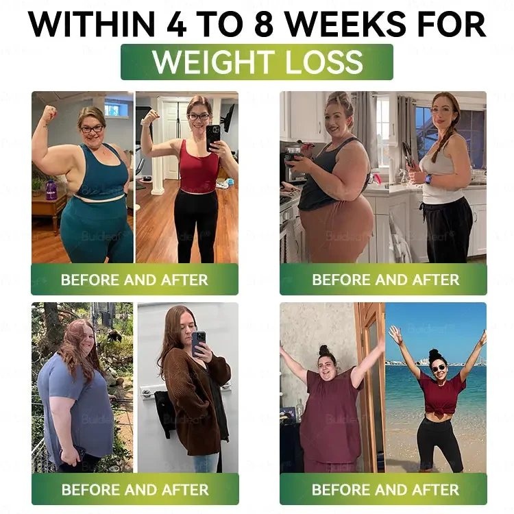 	Buildleaf&reg; SMGT-GLP-1 Nano Microneedle Patch with Collagen Peptides &Matrixyl 3000