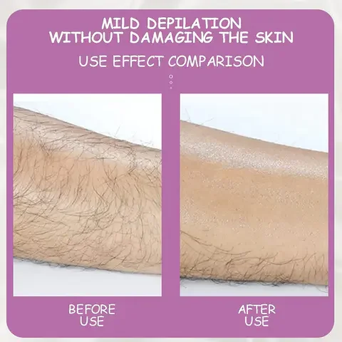 Hairo Crystal Hair Remover