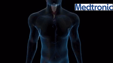 1704638234653157.gif płuca.gif