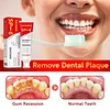 🎁2025 HOT SALE🔥SP-6 Probiotic Whitening Toothpaste
