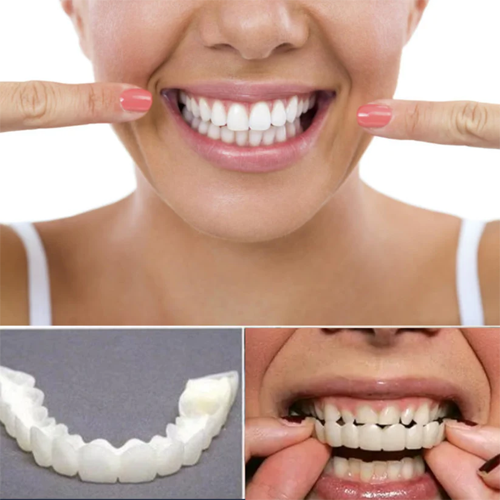 Smile Veneers Instant Snap-on Teeth Veneer