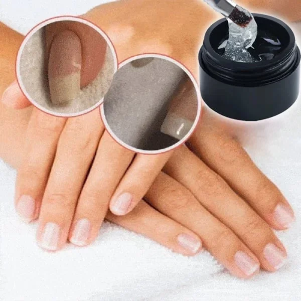 🔥Hot Sale-48% OFF🔥Nail Repair Protection Gel