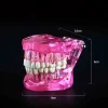 Dental Restoration Model Oral Pathology Doctor-Patient Communication Teaching Restoration Comprehensive With Nerve Part Removable Tooth Model