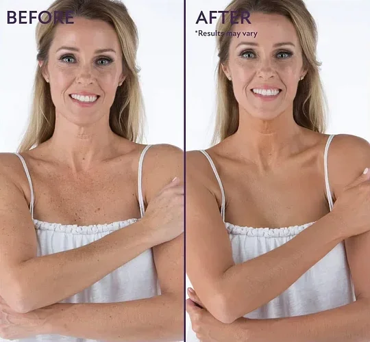 🎉Last Day 49% Off🎁 - All Over Complexion Perfector