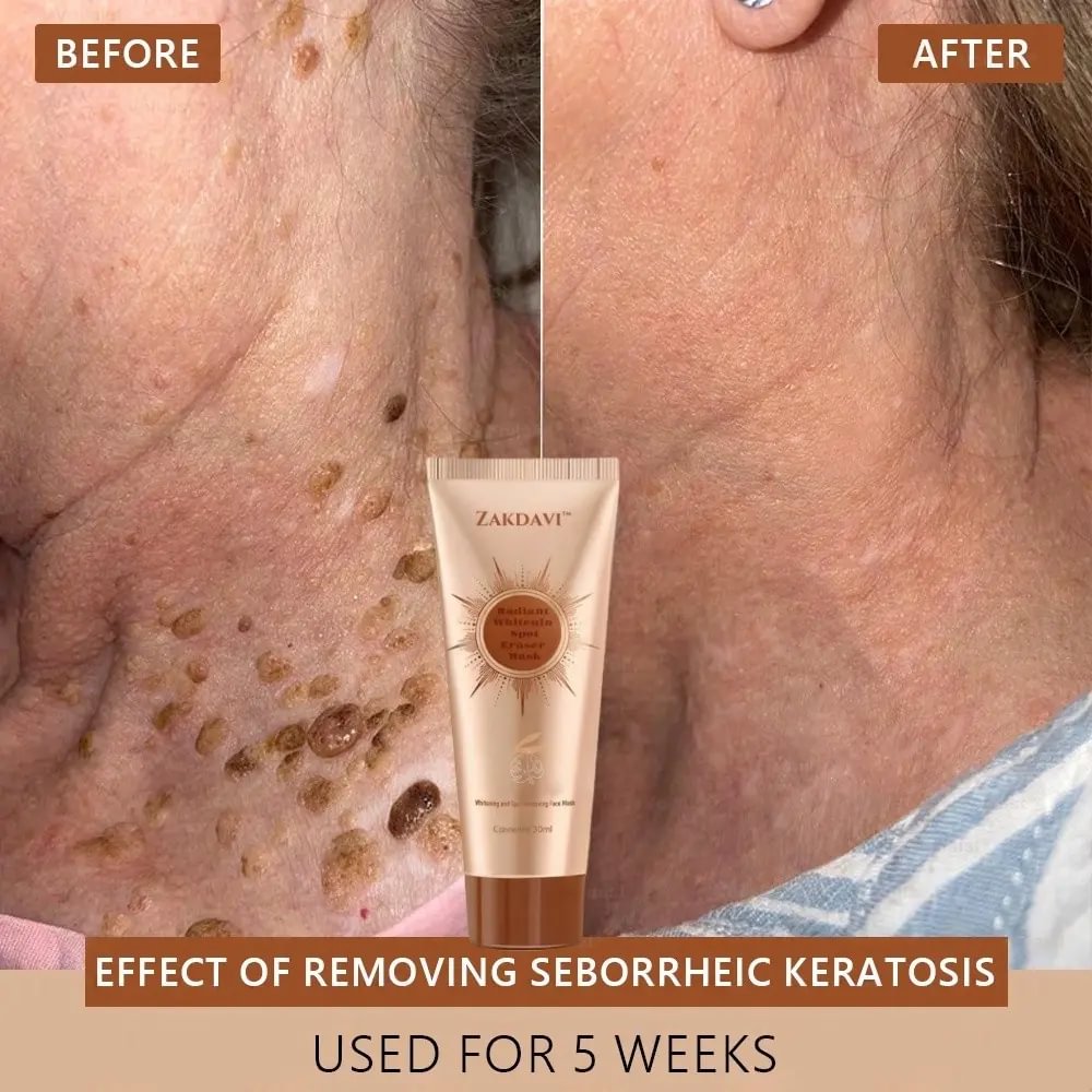 	Zakdavi&trade; Radiant Whitening & Spot Eraser Mask