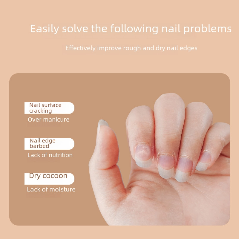 Nail Nutrition Oil Pen Nail Protecting Oil Nourishing Anti-barbed Exfoliating Corneous Finger Skin Softener Nail Care Essential Oil