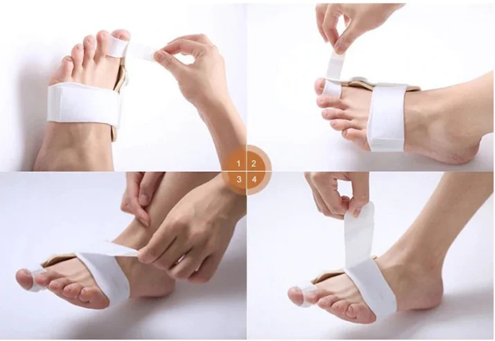 Bunion Splint  Corrector Big Toe Straightener -2 Piece Set