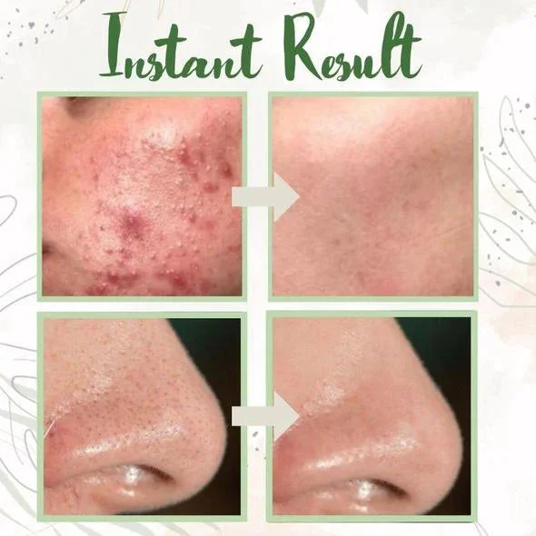 Original Matcha Deep Clean Mask Stick