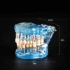 Dental Restoration Model Oral Pathology Doctor-Patient Communication Teaching Restoration Comprehensive With Nerve Part Removable Tooth Model