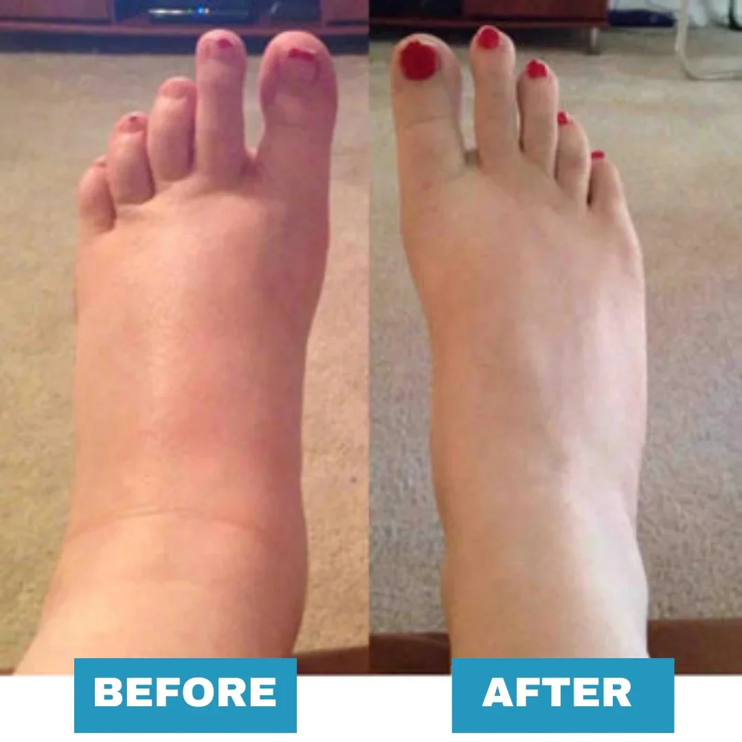 🔥 Summer SALE 60% 🔥 Foot Massager - For Lasting Foot Pain Relief