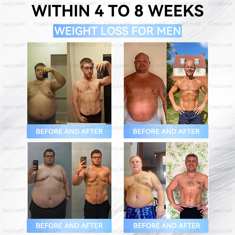 🏥FDA Store | 𝐵uil𝗱𝐿ea𝐟&reg; 𝑺𝑀𝗚T-𝑮𝐋𝑃-1 𝐒limming & 𝐻ealth 𝑁ano 𝑀icroneedle 𝑃atch with Collagen & Matrixyl 3000 丨Obesity,Cardiovascular Diseas, Diabetes, Sleep Apnea, Joint Problems and More