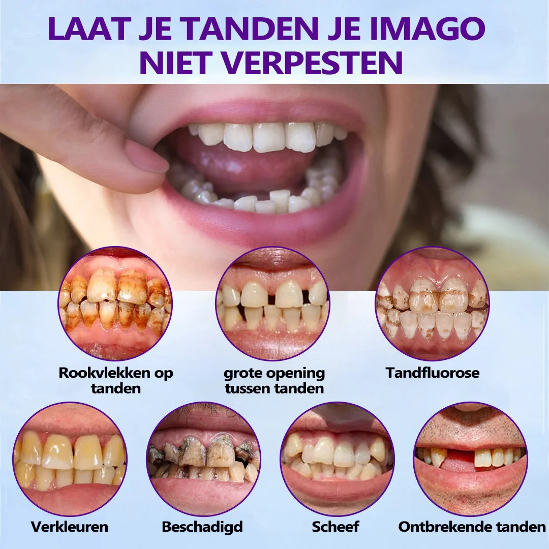 𝐵𝑖𝑘𝑒𝑛𝑑𝑎&trade; Silicium Prothese Meetset🦷（👩&zwj;🔬 Erkend door de Belgische Tandheelkundige Vereniging en goedgekeurd door FAMHP）