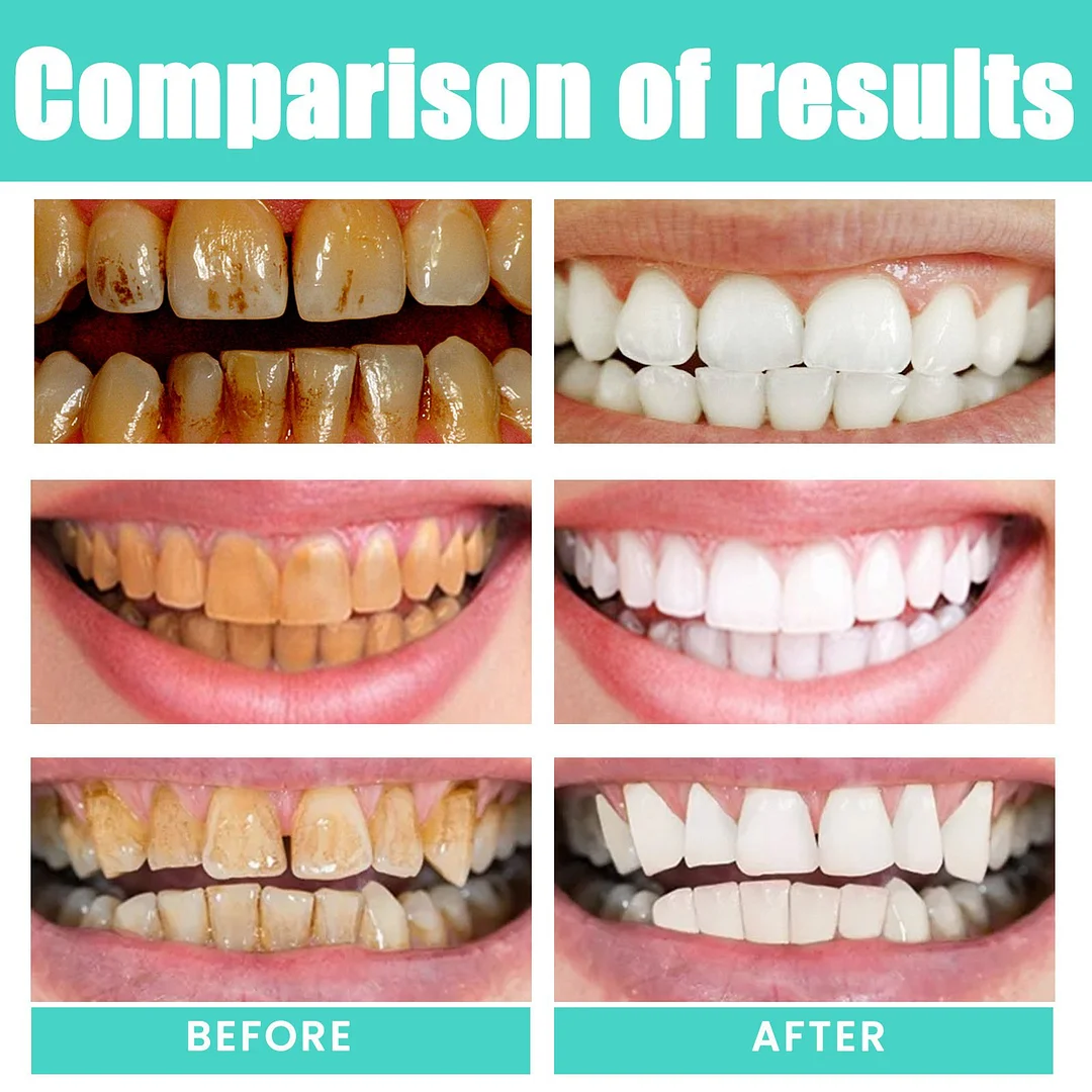 🔥LAST DAY 49% OFF⏰Cocomint Pulling Oil with 7 Essential Oils & Vitamins D. E & K2