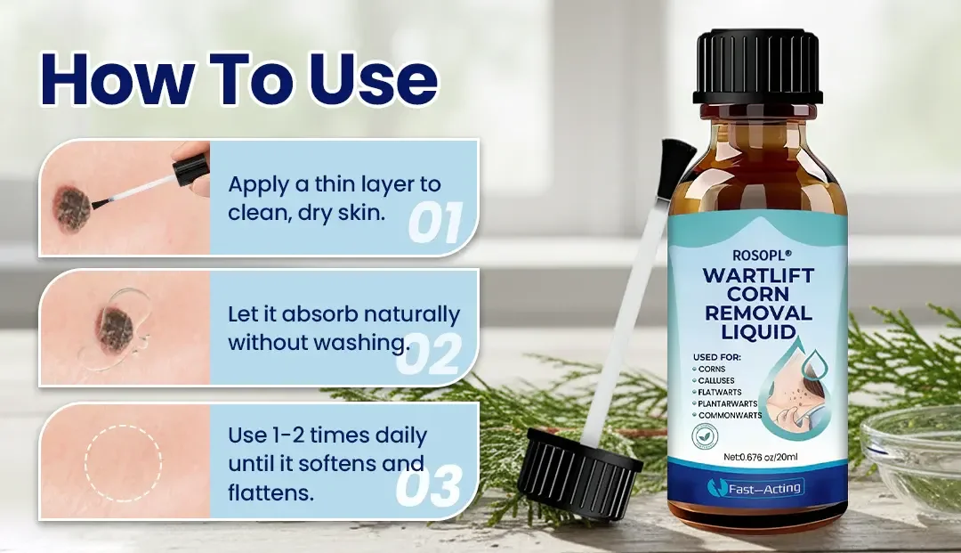 ROSOPL® WartLift Wart Removal Fluid 35