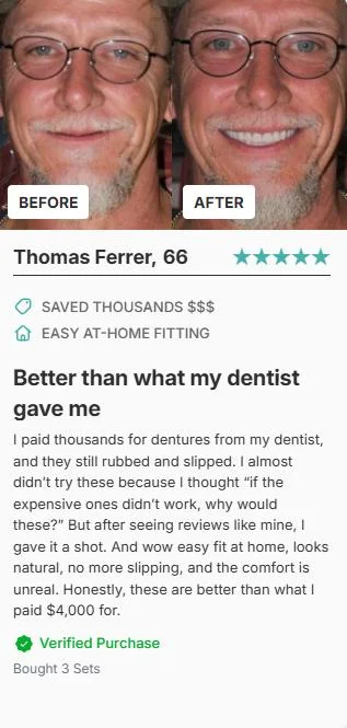 Thomas Ferrer Before After