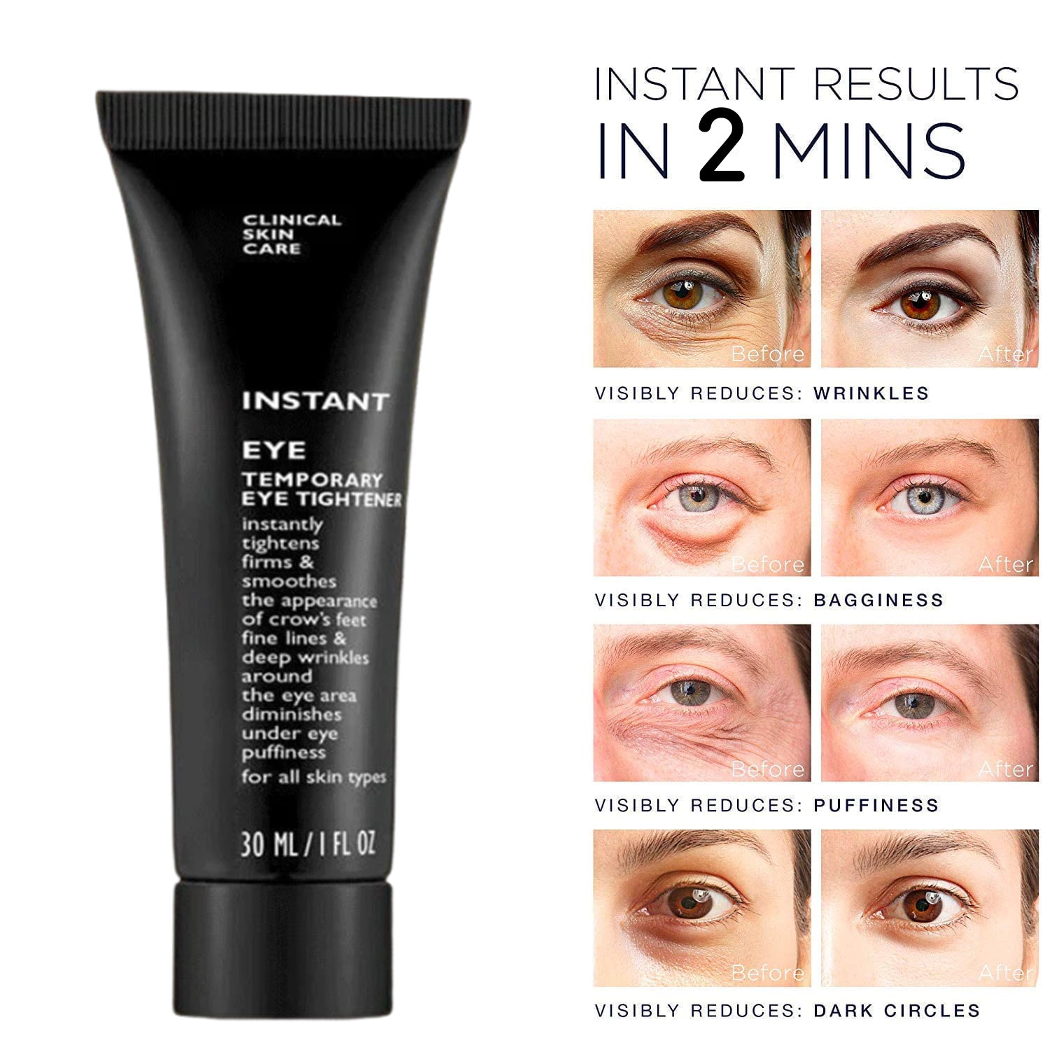 🎁[Free Shipping]Instant Wrinkle Eye Tightener cream